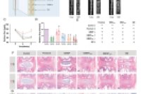 上海交通大学崔文国教授：捕获H+的水凝胶微球，用于阻断炎症中的NLRP3级联反应