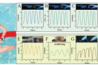 南京工业大学高兵兵副教授：基于滚动微针的仿生超结构微流控微针贴片，用于高效伤口管理