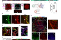 集成功能性血管化类器官芯片的微流控平台