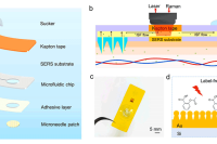 深圳大学张学记教授团队：基于微流控的等离子体微针生物传感器用于尿酸超灵敏监测