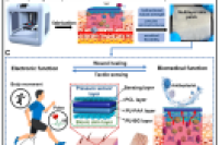 南京工业大学陈苏教授Bioactive Materials：微流控3D生物打印技术构筑先进生物医学/电子双功能皮肤贴片