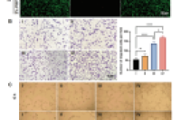 青岛妇女儿童医院生殖医学中心郝翠芳等人：可注射GelMA水凝胶微球持续释放富血小板血浆，用于治疗薄型子宫内膜