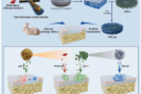 解放军总医院郭全义教授&唐佩福教授：集成生物信号的软骨陷窝仿生水凝胶微球促进内源性关节软骨再生
