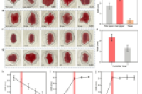 苏州科技大学许兵副教授团队：宣纸与湿度协同增效的微流控血浆分离新策略