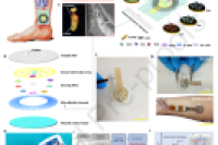 集成微流控通道的柔性多模态生物传感贴片，用于慢性伤口监测