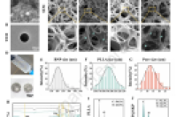南京鼓楼医院秦晓东/朱泽章/刘臻等人：复合肽修饰微流控微球实现成骨微环境的有序调控，以促进骨再生