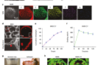 北大口腔医院邓旭亮教授团队：载虫草素的可粘附矿化水凝胶微球，实现NRF2介导的牙周骨再生