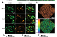 西南交大&成都中医大&西部战区总医院《AFM》：高度可定制多孔核壳微球，成功攻克乳腺癌骨转移3D多微环境建模难题