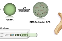 华中科技大学张宇坤&朱锦涛&蒋皓等人：载干细胞可注射水凝胶微球，为椎间盘退变治疗注入新活力