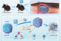 温敏微球-水凝胶复合系统：上海市肿瘤研究所与新华医院携手打造更有效的肝细胞癌联合治疗方案