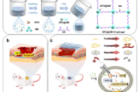 多机制协同的可注射载去铁胺微球水凝胶用于三度烧伤创面愈合