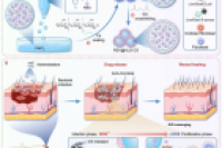负载白藜芦醇的工程微胶囊兼具双重抗菌和ROS清除性能，用于感染伤口愈合