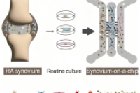 微流控滑膜芯片：还原RA多细胞交互，靶向成纤维样滑膜细胞助药物筛选