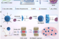 抗炎修复双效！岩藻多糖微球载转录因子，逆转椎间盘退变