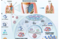 重庆市口腔医院张红梅团队：仿莲花结构纳米-微米复合水凝胶微球，多靶点协同治疗牙周炎