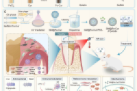 这种可注射复合微球“多管齐下”，协同重塑牙周健康