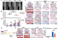 微流控加持！载有软骨细胞靶向外泌体的微球持续输送miR-148a，用于骨关节炎治疗