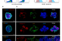 微流控+喷射打印构建皮肤类器官球！揭秘微塑料伤肤机制，加速新药研发