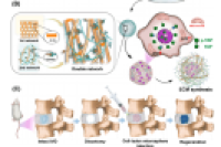 动态双网络水凝胶微球！模拟天然细胞外基质，促进椎间盘髓核再生