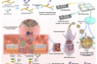 中国海洋大学张兰威教授&林凯副教授：微流控技术制备载益生菌靶向微球，用于治疗炎症性肠病