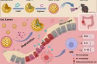 微流控电喷雾制备可食用杂化微球，靶向治疗炎症性肠病