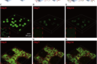 微流控 + 3D 打印！GelMA-海藻酸盐微球支架分阶段释放生长因子，增强骨再生